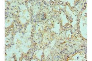 Immunohistochemistry of paraffin-embedded human lung tissue using ABIN7151217 at dilution of 1:100 (SIAH1 antibody  (AA 1-313))