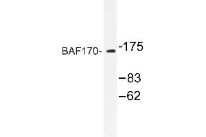 Image no. 1 for anti-SWI/SNF Related, Matrix Associated, Actin Dependent Regulator of Chromatin, Subfamily C, Member 2 (SMARCC2) antibody (ABIN272243) (SMARCC2 antibody)