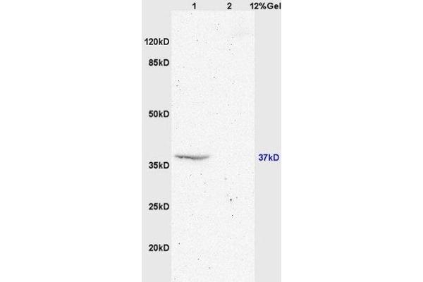 GPR55 antibody  (AA 141-240)