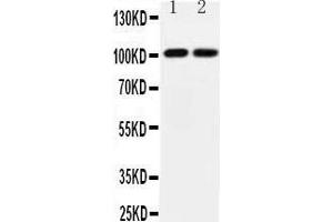 Observed bind size: 101KD (Glutamate Receptor 3 antibody  (Middle Region))