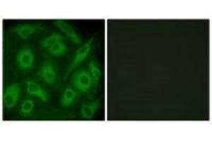 Immunofluorescence analysis of HeLa cells, using CDH23 antibody. (CDH23 antibody)