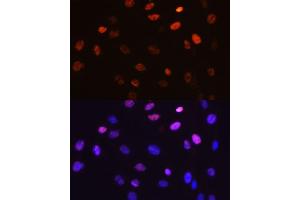 Immunofluorescence analysis of C6 cells using Phospho-c-Jun-S63 antibody (ABIN7268055). (C-JUN antibody  (pSer63))