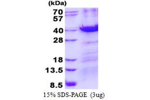 MBD3 Protein (His tag)