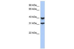 C5ORF35 antibody used at 1 ug/ml to detect target protein. (C5orf35 antibody  (N-Term))