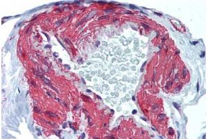 Human Colon, Vessel (formalin-fixed, paraffin-embedded) stained with ACTA2 antibody ABIN337232 at 5 ug/ml followed by biotinylated goat anti-rabbit IgG secondary antibody ABIN481713, alkaline phosphatase-streptavidin and chromogen. (Smooth Muscle Actin antibody  (N-Term))