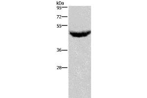 Western Blotting (WB) image for anti-Chemokine (C-X-C Motif) Receptor 2 (CXCR2) antibody (ABIN2431223) (CXCR2 antibody)