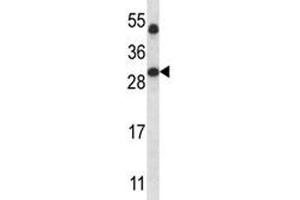 SIRT5 antibody western blot analysis in human placenta tissue lysate. (SIRT5 antibody  (AA 99-127))