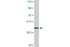 Western Blot detection against Immunogen (37. (MAP3K11 antibody  (AA 741-847))