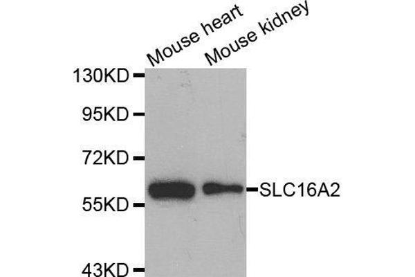 SLC16A2/MCT8 antibody  (AA 1-100)