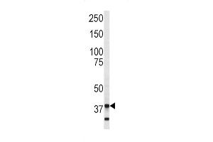 Western blot analysis of Annexin V antibody in SK-Br-3 cell line lysates (35ug/lane) (Annexin V antibody  (C-Term))