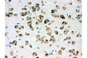 IHC testing of FFPE mouse brain with GRP78 antibody. (GRP78 antibody)