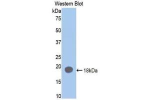 Detection of Recombinant F2, Rat using Polyclonal Antibody to Coagulation Factor II (F2) (Prothrombin antibody  (AA 201-323))