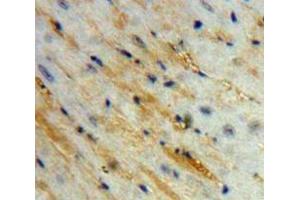 IHC-P analysis of Heart tissue, with DAB staining. (Corin antibody  (AA 334-477))