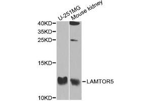 Western blot analysis of extracts of various cell lines, using LAMTOR5 antibody. (HBXIP antibody)