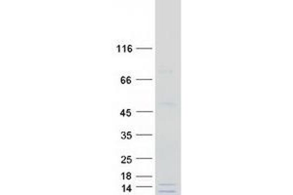 GATC Protein (Myc-DYKDDDDK Tag)