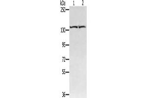 Gel: 6 % SDS-PAGE, Lysate: 40 μg, Lane 1-2: Hela cells, hepg2 cells, Primary antibody: ABIN7130874(RGS22 Antibody) at dilution 1/400, Secondary antibody: Goat anti rabbit IgG at 1/8000 dilution, Exposure time: 20 seconds (RGS22 antibody)