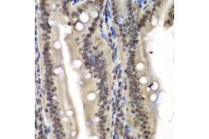 Immunohistochemistry of paraffin-embedded mouse Intestine using NELFE antibody (ABIN6289947) at dilution of 1:100 (40x lens). (RDBP antibody)