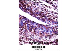 Mouse Adrbk2 Antibody immunohistochemistry analysis in formalin fixed and paraffin embedded mouse cervix tissue followed by peroxidase conjugation of the secondary antibody and DAB staining. (ADRBK2 antibody  (C-Term))