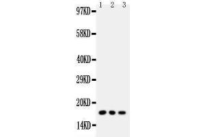 Western Blotting (WB) image for anti-Caveolin 2 (CAV2) (AA 1-17), (N-Term) antibody (ABIN3042683) (Caveolin 2 antibody  (N-Term))