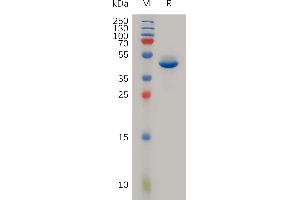 Human NTS Protein, hFc Tag on SDS-PAGE under reducing condition. (Neurotensin Protein (NTS) (AA 24-148) (Fc Tag))