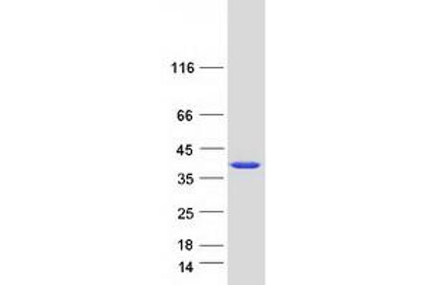 AIDA Protein (Myc-DYKDDDDK Tag)