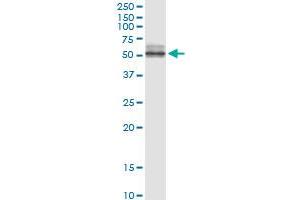 Immunoprecipitation of NPTX2 transfected lysate using anti-NPTX2 MaxPab rabbit polyclonal antibody and Protein A Magnetic Bead , and immunoblotted with NPTX2 MaxPab mouse polyclonal antibody (B01) . (NPTX2 antibody  (AA 1-431))