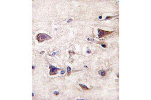 Formalin-fixed and paraffin-embedded human brain tissue reacted with PDGFA antibody (N-term), which was peroxidase-conjugated to the secondary antibody, followed by DAB staining. (PDGFA antibody  (N-Term))