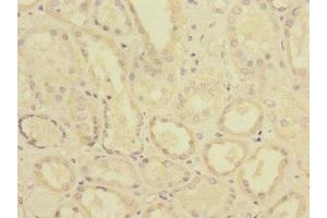 Immunohistochemistry of paraffin-embedded human kidney tissue using ABIN7174111 at dilution of 1:100 (PTPN4 antibody  (AA 1-240))