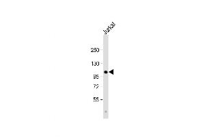 Western Blot at 1:1000 dilution + Jurkat whole cell lysate Lysates/proteins at 20 ug per lane. (PARG antibody  (C-Term))