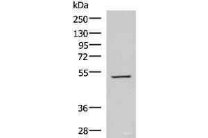 Western blot analysis of HepG2 cell lysate using FDXR Polyclonal Antibody at dilution of 1:1000 (Ferredoxin Reductase antibody)