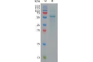 SARS-CoV-2 (Omicron BA. (SARS-CoV-2 Spike Protein (BA.5 - Omicron, RBD) (Fc Tag))