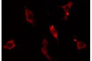 ABIN6275093 staining  Hela cells by IF/ICC. (RNF125 antibody  (Internal Region))