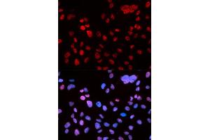 Immunofluorescence (IF) image for anti-Tumor Protein P53 (TP53) (pSer9) antibody (ABIN1870676) (p53 antibody  (pSer9))