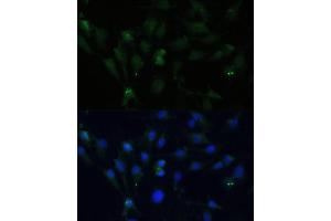 Immunofluorescence analysis of C6 cells using ZWINT Polyclonal Antibody (ABIN6128944, ABIN6150552, ABIN6150554 and ABIN6221938) at dilution of 1:100 (40x lens). (ZWINT antibody  (AA 1-277))
