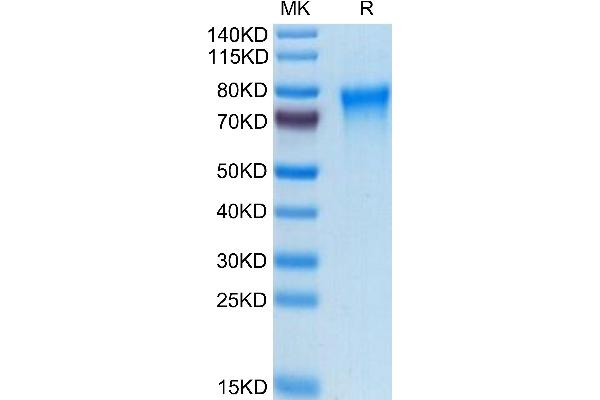 TREML2 Protein (AA 19-268) (His tag)