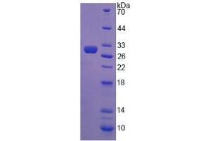 Image no. 1 for Anti-Mullerian Hormone (AMH) (AA 409-644) protein (His tag) (ABIN5665217) (AMH Protein (AA 409-644) (His tag))