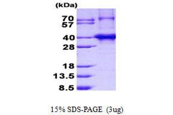 TNRC5 Protein (His tag)