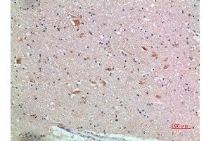 Immunohistochemical analysis of paraffin-embedded human-brain, antibody was diluted at 1:200 (FZD9 antibody  (AA 1-50))