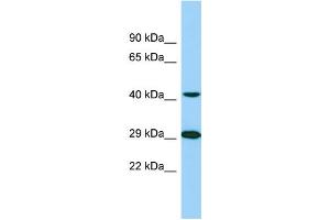 Western Blotting (WB) image for anti-Tubulin tyrosine Ligase-Like Family, Member 1 (TTLL1) (C-Term) antibody (ABIN2500807) (TTLL1 antibody  (C-Term))