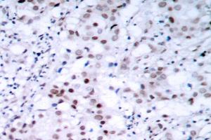 Image no. 2 for anti-Tumor Protein P53 (TP53) antibody (ABIN272050) (p53 antibody)