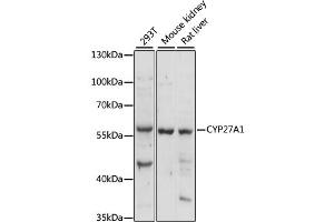 Western blot analysis of extracts of various cell lines, using CYP27A1 antibody (ABIN6291940) at 1:1000 dilution. (CYP27A1 antibody)