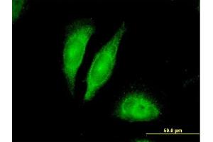 Immunofluorescence of purified MaxPab antibody to BDNF on HeLa cell. (BDNF antibody  (AA 1-255))