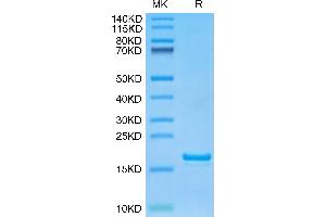 Monkeypox virus L1R on Tris-Bis PAGE under reduced condition. (MPXV L1R (AA 1-152) protein (His tag))