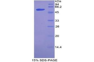 SDS-PAGE analysis of Mouse ACE Protein. (Angiotensin I Converting Enzyme 1 Protein)