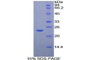 SDS-PAGE analysis of Mouse MST1R Protein. (MST1R Protein)