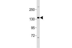 Western blot testing of ERBB4 antibody at 1:2000 dilution + MCF-7 lysate (ERBB4 antibody  (AA 1141-1166))