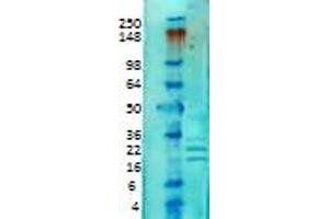 KCHIP Western Blot. (KCNIP1 antibody)