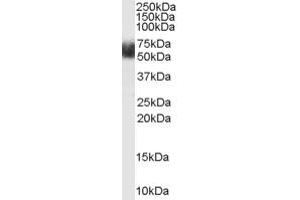 Western Blotting (WB) image for anti-F-Box and Leucine-Rich Repeat Protein 3 (FBXL3) (N-Term) antibody (ABIN2465686) (FBXL3 antibody  (N-Term))