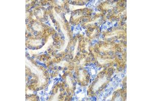 Immunohistochemistry of paraffin-embedded rat kidney using FAH antibody at dilution of 1:100 (x40 lens). (FAH antibody)