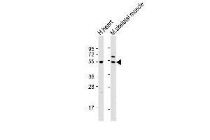 Western Blotting (WB) image for anti-Pyruvate Dehydrogenase Kinase, Isozyme 4 (PDK4) (AA 382-410), (C-Term) antibody (ABIN391039)